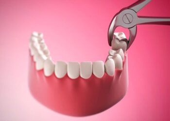 Видалення зуба — особливості процедури, доцільність, вартість