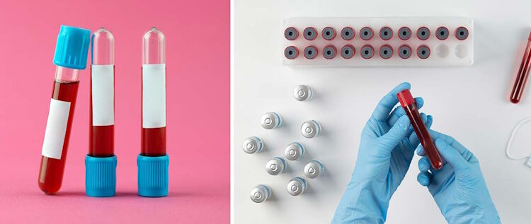 пробирки для забора крови