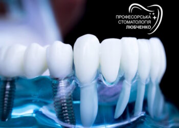 імплантація