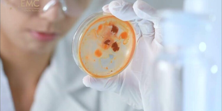 Карциноїдні пухлини кишківника